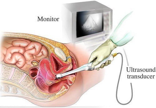 Siêu âm được sử dụng để chẩn đoán các vấn đề về gan, thận, túi mật, tim hoặc trong sản khoa