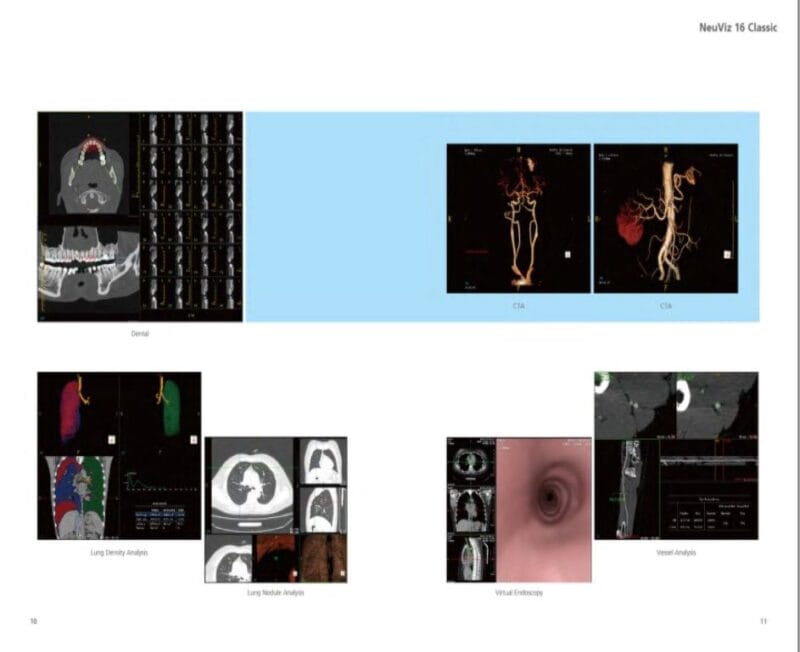 Hệ thống chụp CT 16 lát - Neuviz 16 Classic - Neusoft Medical Systems