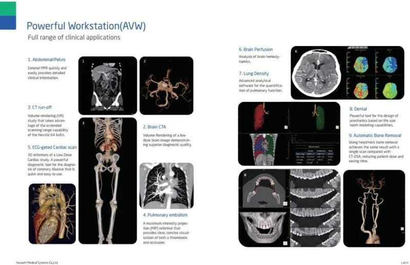 Hệ thống chụp CT 64 lát - Neuviz 64 In - Neusoft Medical Systems